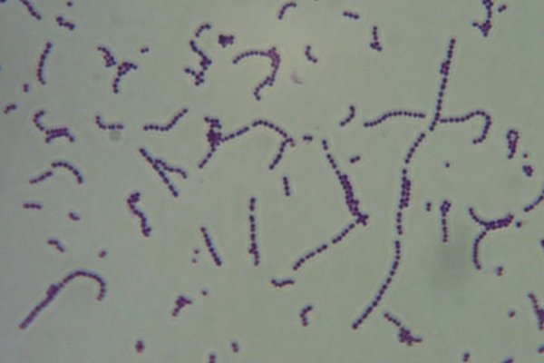 <i>Streptococcus agalactiae</i>