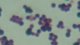 <p><b>Fig. 20:5.</b> Gram staining of <i>Staphylococcus aureus</i> subsp. <i>aureus</i>.</p>

<p> </p>
