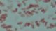 <p><b>Fig. 60:9.</b> Gram-färgning av <i>Mannheimia haemolytica</i>.</p>

<p> </p>