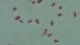 <p><strong>Fig. 107:3.</strong> Gram staining of <i>Actinobacillus equuli</i> subsp. <i>equuli</i>.</p><p> </p>