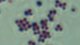 <b>Fig. 23:3.</b>Gram-färgning av <i>Staphylococcus hyicus</i>. <p>