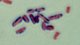 <strong>Fig. 29:3.</strong> Gram staining of <i>Clostridium perfringens</i>. Note that the cells have not been evenly stained by the gram staining. <p>