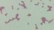 <b>Fig 17:3.</b> Gram-färgning av <i>Streptococcus dysgalactiae</i> subsp. <i>dysgalactiae</i>. Gramfärgningen har tagit ojämnt och kedjorna är inte så snygga. <p>