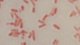 <p><strong>Fig. 142:3. </strong>Gram-färgning av <i>Citrobacter freundii</i>.</p>

<p> </p>