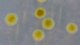 Närbild på kolonier av <i>Flavobacterium psychrophilum</i> (stam F439) odlad på TYES-agar vid 20°C efter 4 dygn. Den totala längden på skalstrecket motsvarar 5 mm. <p>