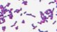 <p>Gram-färgning av <i>Renibacterium salmoninarum</i>, stam R.s 28/2.</p>

<p> </p>