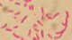 <p>Gram-färgning av <i>Vibrio vulnificus</i>. Notera utseendet på de böjda stavarna.</p>

<p> </p>