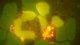 <p><strong>Fig. 45:1.</strong> Acridinorange-färgning för <i>Anaplasma phagocytophilum</i> av blodutstryk. Erythrocyter omger en granulocyt med cellkärna. I granulocyten kan man också se en morulae med tätt packade anaplasmor samt några fria anaplasmor.</p>

<p> </p>