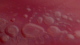 <strong>Fig. 140:2.</strong> Närbild på kolonier av "<i>Brachyspira suanatina</i>", stam AN4859/03, odlad på FAA-agar under 3 dygn vid 42°C i anaerobklocka. <p>