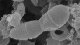 Svepelektronmikroskopibild av <i>Melissococcus plutonius</i>. Intakta bakterier syns i centrum av bilden. Notera att bakterierna föreligger som diplokocker och att man kan ana var de kommer att dela sig nästa gång. Hela skalstrecket motsvarar 1 µm. <p>
