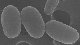 <p><strong>Fig. 179:1.</strong> Svepelektronmikroskopibild av sporer från <i>Paenibacillus larvae</i>, genotyp ERIC I, stam 176-97. Man ser tre intakta sporer i centrum av bilden. Hela skalstrecket motsvarar 1 µm.</p>

<p> </p>