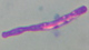 <p><b>Fig. 11:2.</b> Kapselfärgning med metylenblått av <i>Bacillus anthracis</i> från <b>mjältbrandsutbrottet i Halland i december, 2008</b>. Baktererna odlades först på blodagar och därefter i hästserum under 6 timmar.</p>

<p> </p>