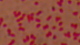 <strong>Fig. 55:3.</strong> Gram-färgning av <i>Bordetella pertussis</i>.
<p>