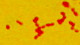<p><strong>Fig. 57:2. </strong>Gram-färgning av <i>Actinobacillus pleuropneumoniae</i>, stam CCUG 12837T.</p>

<p> </p>