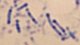 <strong>Fig. 104:2.</strong> Metylenblått- (MB-)färgning av <i>Dichelobacter nodosus</i>, stam .... Notera typiska mörka granulae, framför allt vid polerna, som framträder vid MB-färgning. <p>