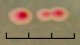 <strong>Fig. 190:6.</strong> Närbild på kolonier av <i>Enterococcus faecium</i>, stam VRE 300/04, odlad aerobt under två dygn på SlaBa-agar med vankomycin vid 37°C. Skalstreckets totala längd motsvarar 3 mm. Slanetz-Bartley-agar innehåller bl.a. tetrazoliumklorid, som reduceras till olösligt formazon (lilaröd färg) av enterokocker. Notera också precipitationszonen runt kolonierna. <p>
