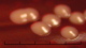 <strong>Fig. 135:2.</strong> Kolonier av <i>Staphylococcus pseudintermedius</i>, stam VB 001/09, odlad aerobt under ett dygn på nötblod-agar vid 37°C. Längden på hela skalstrecket motsvarar 5 mm.
<p>