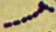 <strong>Fig. 15:4.</strong> Gram-färgning av <i>Streptococcus equi</i> subsp. <i>zooepidemicus</i>, stam VB 003/09. 
<p>