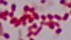 <p><strong>Fig. 106:3.</strong> Gram-färgning av <i>Actinobacillus lignieresii</i>, stam B10375/10. Längden på skalstrecket motsvarar 5 µm. Datum: 2010-04-23.</p>

<p> </p>