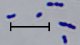 <p><b>Fig. 1:5.</b> Gramfärgning av <i>Trueperella pyogenes</i>, stam CCUG 13230<sup>T</sup>. Längden på skalstrecket motsvarar 5 µm. Datum: 2010-05-21.</p>

<p> </p>