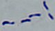 <p><b>Fig 3. </b>Gramfärgning av <i>Erysipelothrix rhusiopathiae</i>. Notera det "ostkrokelika" utseendet. Längden på skalstrecket motsvarar 5 µm. Datum: 2010-06-03.</p>

<p> </p>