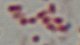 <p><strong>Fig. 199:3. </strong>Gram staining of <i>Mannheimia granulomatis</i>, strain BKT 20776/10. The length of the scale bar is equivalent to 5 µm. Date 20010-06-10.</p>

<p> </p>