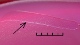 <p><b>Fig. 2. </b>Närbild på kolonier av <i>Clostridium tetani</i>, stam PAT 2483/10, odlad anaerobt på FAA-plattor under 1 vecka vid 37°C. Med en plastögla gjordes ett stryk över agarytan för att visa att bakterier ansamlas i kanterna på stryket (se pilen). Längden av hela skalstrecket motsvarar 5 mm. Bakterierna kommer från ett avslutat fall av sårinfektion på ett får. Datum: 2010-06-10.</p>

<p> </p>