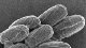 <p><strong>Fig. 11:5.</strong> Spores of <i>Bacillus anthracis</i>. This strain is of biotype Sterne. Different strains of <i>B. anthracis</i> form spores, which can be of two morphological types, either almost sphaeric or more elongated. The depicted strain forms more elongated spores (c.f. Fig. 11:4).The length of the scale bar is equivalent to 1 µm. Date: 2010-06-15.</p>

<p> </p>