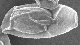 <p><strong>Fig. 21:4.</strong> Sporer av <em>Bacillus cereus</em>, stam NVH 0597-99. Denna stam bildar ett exosporium, som syns ovanligt tydlig (se pilen) och ligger som en utsmetad plastpåse runt sporen (jfr. Fig. 3.). Sporer av <em>B. anthracis</em> och <em>B. thuringiensis</em> omges också av ett exosporium, som alltså är ytterligare ett hölje som finns utanför det normala sporhöljet. Längden på skalstrecket motsvarar 1 µm. Datum: 2010-06-16.</p>

<p> </p>