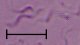 <b>Fig. 98:3.</b> Faskontrastmikroskopi av levande <i>Brachyspira pilosicoli</i>, stam P43/6/78<sup>T</sup>. Längden av skalstrecket motsvarar 5 µm. Kulturer av <i>B. pilosicoli</i> ser ofta skräpigare ut än <i>B. hydysenteriae</i> (jfr. Fig. 97:3-4). Datum: 2010-06-23. <p>