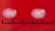 <b>Fig. 19:2.</b> Closeup of colonies of <i>Streptococcus uberis</i> on bovine blood agar after cultivation during 24 h at 37°C. The total length of the scale bar is equivalent to 5 mm. Date: 2010-10-02. <p>
