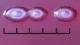 <b>Fig. 65:3.</b> Closeup of colonies of <i>Pseudomonas aeruginosa</i>, strain ATCC 27853, cultivated aerobically on horse blood agar during 3 days at 37°C. The total length of scale bar is equivalent to 5 mm. Date: 2010-10-06. <p>