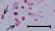 <p><b>Fig. 60:8.</b> Gramfärgning av <i>Mannheimia haemolytica</i>, stam PAT 4483/10. Bakterierna vid pilarna håller troligen på att dela sig. Längden på skalstrecket motsvarar 5 µm. Datum: 2010-10-06.</p>

<p> </p>