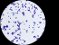 <p><b>Fig. 205:4.</b> Gramfärgning av <i>Staphylococcus epidermidis</i>, stam VB005/11. Längden av skalstrecket motsvarar 5 µm. Datum: 2011-03-14.</p>

<p> </p>