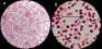 <p><b>Fig. 67:4.</b> Gramfärgning av <i>Moraxella bovis</i>, stam BKT 14841/10. Pilarana visar på bakterier, som föreligger som par (vanligt). Synfältet B är en delförstoring (6 gånger) av A. Längderna av skalstrecken motsvarar 5 µm. Datum: 2011-03-25.</p>

<p> </p>