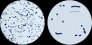 <b>Fig. 19:3.</b> Gram-färgning av <i>Streptococcus uberis</i>, stam VB 004/11. Förstoringsgrad och del av synfält skiljer de båda bilderna åt. Längden på skalstrecken motsvarar i båda bilderna 5 µm. Datum: 2011-04-11. <p>