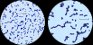 <p><b>Fig. 16:6.</b> Gram-färgning av <i>Streptococcus agalactiae</i>, stam 09mas018883. Endast förstoringsgrad skiljer de båda bilderna åt. Längden på skalstrecken motsvarar i båda bilderna 5 µm. Datum: 2011-04-11.</p>

<p> </p>