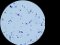 <b>Fig. 207:5.</b> Gram-färgning av <i>Streptococcus canis</i>, stam CCUG 37323. Längden på skalstrecket motsvarar 5 µm. Datum: 2011-06-08. <p>