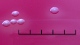 <b>Fig. 207:2.</b> Närbild på kolonier av <i>Streptococcus canis</i>, stam CCUG 37323, odlad aerobt på nötblodagar med eskulin vid 37°C under 24 tim. Fotograferad med ljus ovanifrån. Längden av hela skalstrecket motsvarar 5 mm. Datum: 2011-06-08. <p>
