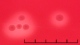 <b>Fig 207:3.</b> Närbild på kolonier av <i>Streptococcus canis</i>, stam CCUG 37323, odlad aerobt på nötblodagar med eskulin vid 37 °C under 24 tim. Fotograferad med ljus underifrån. Notera den relativt breda hemolyszonen runt kolonierna. Längden av skalstrecket motsvarar 5 mm. Datum: 2011-06-08. <p>