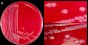 <p><b>Fig. 70:1</b> Colonies of <i>Salmonella enterica</i> subsp. <i>enterica</i> serovar Dublin, strain SLV 242, cultivated on bovine blood agar at 37°C during 24 h. A and B, with lighting primarely from above. C, with lighting primarerly from the side. Note the for salmonella typical cone shaped appearence of the colonies, which is best observed in C. The total lengths of the scale bars are equivalent to A, 1 cm; B and C, 5 mm. Date: 2012-01-19.</p>

<p> </p>