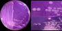 <b>Fig. 70:3</b> Colonies of <i>Salmonella enterica</i> subsp. <i>enterica</i> serovar Dublin, strain SLV 242, cultivated on purple agar with lactose at 37°C during 24 h. A and B, with lighting primarely from above. C, with lighting primarirly from the side. Note the for salmonella typical cone shaped appearence of the colonies, which is best observed in C. The pale colonies around the arrow in C are i fact mirror images of colonies above. Thus, these colonies are seen from underneath (c.f. C, which shows the same area of the agar plate. The total lengths of the scale bars are equivalent to A, 1 cm; B and C, 5 mm. Date: 2012-01-19.
<p>