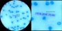 <p><strong>Fig. 11:3.</strong> Kapselfärgning med metylenblått av <em>Bacillus anthracis</em> i blodutstryk. En "kedja" av bakterier syns under skalstrecken. Den högra bilden är en delförstoring av den vänstra. Längderna av skalstrecken motsvarar 10 µm i båda bilderna.</p>

<p> </p>