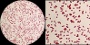 <p><strong>Fig. 68:3.</strong> Gramfärgning av <i>Escherichia coli</i>, stam VB 008/14. Den högra bilden är en delförstoring (ca 2,5x) av den vänstra. Hela längden av respektive skalstreck motsvarar 5 µm och skalorna är placerade i motsvarande delar av bilderna. Datum: 2013-12-22.</p>

<p> </p>

<p> </p>