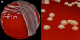 <p><strong>Fig. 23:1.</strong> Kolonier av <i>Staphylococcus hyicus</i> odlad på nötblodagar under 24 timmar vid 37° C. Plattan är fotograferad med belysning från ovan. A, hela plattan. B, delförstoring av A. Den totala längden på skalstrecken motsvarar 1 cm resp. 5 mm. Datum: 2014-10-24.</p>

<p> </p>