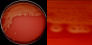 <p><strong>Fig. 14:2.</strong> Bild A. Kolonier av <i>Streptococcus equi</i> subsp. <i>equi</i> odlad på nötblodagar vid 37 °C under 48 timmar. Agarplattan fotograferades <strong>med ljus underifrån</strong>. Bild B. Delförstoring av agarplatan t.v. Den klara β-hemolysen syns tydligt i båda bilderna. Hela längden av skalstrecken motsvarar 1 cm resp. 3 mm. Datum: 2014-11-19.</p>

<p> </p>