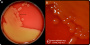 <p><strong>Fig. 14:1.</strong> Bild A. Kolonier av <i>Streptococcus equi</i> subsp. <i>equi</i> odlad på nötblodagar vid 37 °C under 48 timmar. Agarplattan är fotograferad med <strong>ljus underifrån</strong>. Bild B. Delförstoring av agarplatan t.v. Här kan man ana β-hemolysen, men den syns tydligare med ljus underifrån. Hela längden av skalstrecken motsvarar 1 cm resp. 3 mm. Datum: 2022-01-23.</p>

<p> </p>