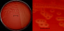 <p><strong>Fig. 16:2.</strong> A. Kolonier av <i>Streptococcus agalactiae</i>, stam VB 0006/11, odlad på nötblodagar vid 37 °C under 24 timmar. Agarplattan fotograferades <strong>med ljus underifrån</strong>. B. Delförstoring av agarplatan t.v. Den klara β-hemolysen syns tydligt på båda bilderna. Denna stam har en förhållandevis bred hemolyszon. Hela längden av skalstrecken motsvarar 1 cm resp. 3 mm. Datum: 2014-11-19.</p>