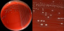 <strong>Fig. 16:1.</strong> A. Kolonier av <i>Streptococcus agalactiae</i>, stram VB 0006/11, odlad på nötblodagar vid 37 °C under 24 timmar. Agarplattan fotograferades <strong>med ljus ovanifrån</strong>. B. Delförstoring av agarplatan t.v. Man kan ana β-hemolysen, men den syns tydligare med ljus underifrån (se Fig. 16:2). Hela längden av skalstrecken motsvarar 1 cm resp. 3 mm. Datum: 2014-11-19.</p>
