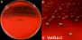 <strong>Fig. 15:1.</strong> A. Kolonier av <i>Streptococcus equi</i> subsp. <i>zooepidemicus</i> odlad på nötblodagar vid 37 °C under 48 timmar. Agarplattan fotograferades <strong>med ljus ovanifrån</strong>. B. Delförstoring av agarplatan t.v. Man kan se β-hemolysen på båda bilderna men den syns tydligare med ljus underifrån (se Fig. 15:2/3). Hela längden av skalstrecken motsvarar 1 cm. Datum: 2014-11-24.</p>